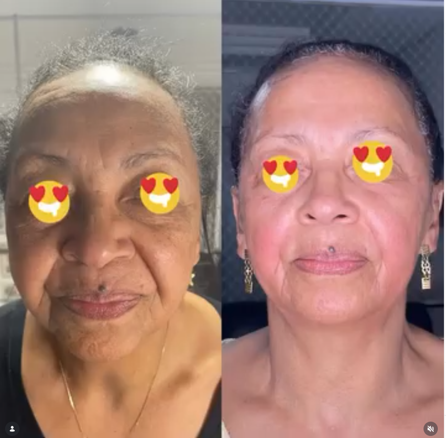 Resultado real antes e depois