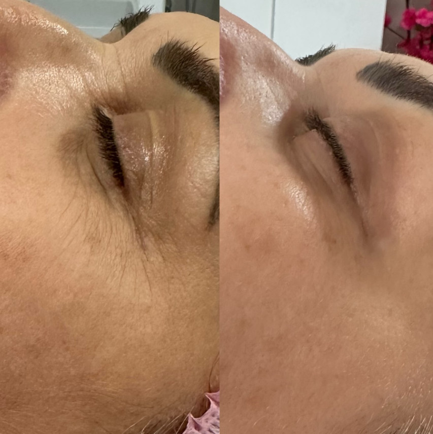 Resultado real antes e depois